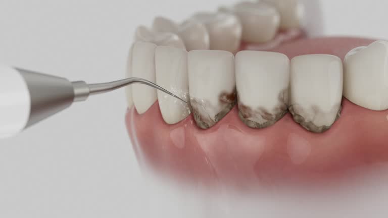 Trusted Tooth Extraction service in Wilson, AR - Dentist Open Now